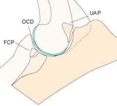 elbow_diseases_small.png