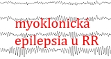 myoklonicka-epilepsia-RR.jpg